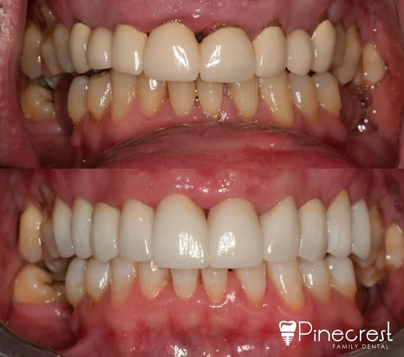 teeth